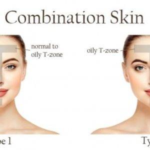 A_Guide_to_Dry_Oily_and_Combination_Skin-1 (4)