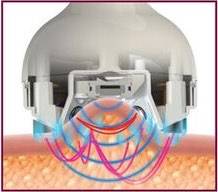 8 venus_legacy_device_selfology skincare expert (3)