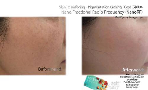 39582fA2B7A66B-010C-367C-6C4D-92B1301EBCF7jpg 400